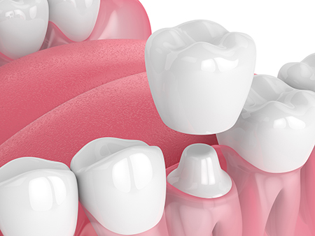 New Smile Dentistry
