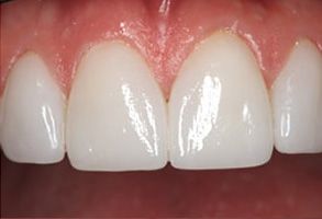 New Smile Dentistry | Oral CDx reg , Implant Dentistry and Cosmetic Dentistry