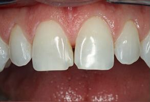 New Smile Dentistry | Emergency Treatment, Implant Dentistry and Oral Exams